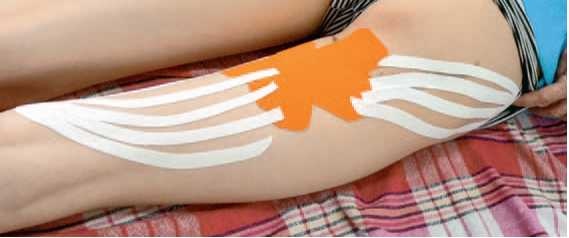 Иллюстрация к книге — Кинезиотейпинг в лечебной практике неврологии и ортопедии [i_186.jpg]