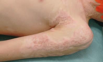 Иллюстрация к книге — Кинезиотейпинг в лечебной практике неврологии и ортопедии [i_191.jpg]