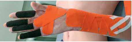 Иллюстрация к книге — Кинезиотейпинг в лечебной практике неврологии и ортопедии [i_192.jpg]