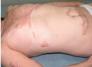 Иллюстрация к книге — Кинезиотейпинг в лечебной практике неврологии и ортопедии [i_197.jpg]