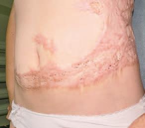 Иллюстрация к книге — Кинезиотейпинг в лечебной практике неврологии и ортопедии [i_200.jpg]