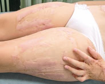 Иллюстрация к книге — Кинезиотейпинг в лечебной практике неврологии и ортопедии [i_201.jpg]