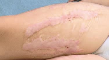 Иллюстрация к книге — Кинезиотейпинг в лечебной практике неврологии и ортопедии [i_202.jpg]