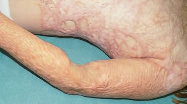 Иллюстрация к книге — Кинезиотейпинг в лечебной практике неврологии и ортопедии [i_207.jpg]