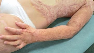 Иллюстрация к книге — Кинезиотейпинг в лечебной практике неврологии и ортопедии [i_208.jpg]