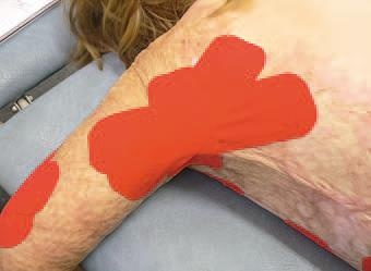 Иллюстрация к книге — Кинезиотейпинг в лечебной практике неврологии и ортопедии [i_212.jpg]