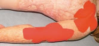 Иллюстрация к книге — Кинезиотейпинг в лечебной практике неврологии и ортопедии [i_217.jpg]