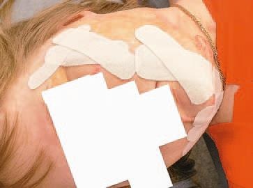 Иллюстрация к книге — Кинезиотейпинг в лечебной практике неврологии и ортопедии [i_219.jpg]