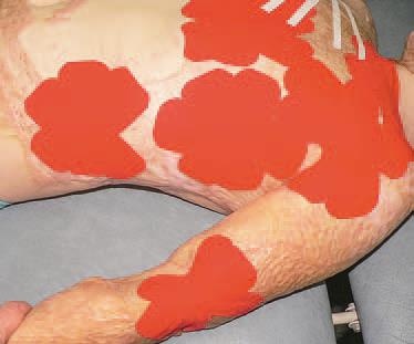 Иллюстрация к книге — Кинезиотейпинг в лечебной практике неврологии и ортопедии [i_222.jpg]