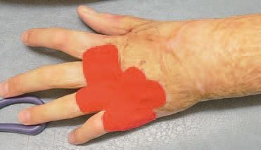 Иллюстрация к книге — Кинезиотейпинг в лечебной практике неврологии и ортопедии [i_223.jpg]