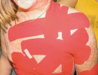 Иллюстрация к книге — Кинезиотейпинг в лечебной практике неврологии и ортопедии [i_226.jpg]