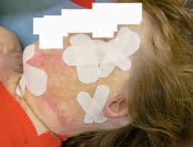 Иллюстрация к книге — Кинезиотейпинг в лечебной практике неврологии и ортопедии [i_228.jpg]