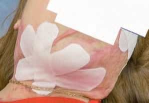 Иллюстрация к книге — Кинезиотейпинг в лечебной практике неврологии и ортопедии [i_229.jpg]