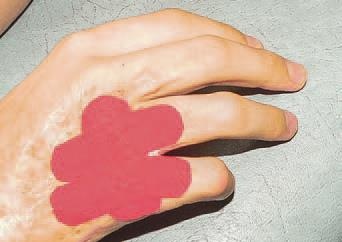 Иллюстрация к книге — Кинезиотейпинг в лечебной практике неврологии и ортопедии [i_235.jpg]