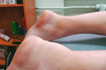 Иллюстрация к книге — Кинезиотейпинг в лечебной практике неврологии и ортопедии [i_236.jpg]