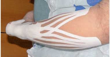 Иллюстрация к книге — Кинезиотейпинг в лечебной практике неврологии и ортопедии [i_238.jpg]