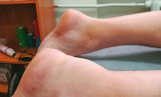 Иллюстрация к книге — Кинезиотейпинг в лечебной практике неврологии и ортопедии [i_240.jpg]