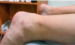 Иллюстрация к книге — Кинезиотейпинг в лечебной практике неврологии и ортопедии [i_243.jpg]