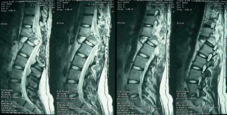 Иллюстрация к книге — Кинезиотейпинг в лечебной практике неврологии и ортопедии [i_247.jpg]