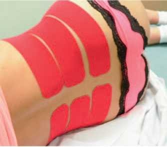 Иллюстрация к книге — Кинезиотейпинг в лечебной практике неврологии и ортопедии [i_252.jpg]