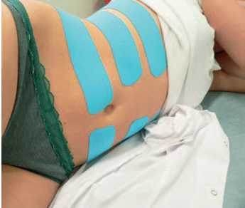 Иллюстрация к книге — Кинезиотейпинг в лечебной практике неврологии и ортопедии [i_253.jpg]