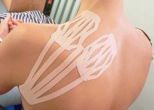 Иллюстрация к книге — Кинезиотейпинг в лечебной практике неврологии и ортопедии [i_265.jpg]