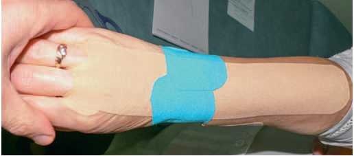 Иллюстрация к книге — Кинезиотейпинг в лечебной практике неврологии и ортопедии [i_270.jpg]