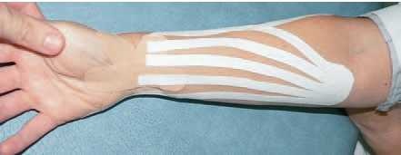 Иллюстрация к книге — Кинезиотейпинг в лечебной практике неврологии и ортопедии [i_272.jpg]