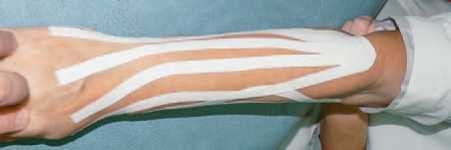 Иллюстрация к книге — Кинезиотейпинг в лечебной практике неврологии и ортопедии [i_273.jpg]