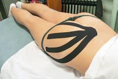 Иллюстрация к книге — Кинезиотейпинг в лечебной практике неврологии и ортопедии [i_276.jpg]