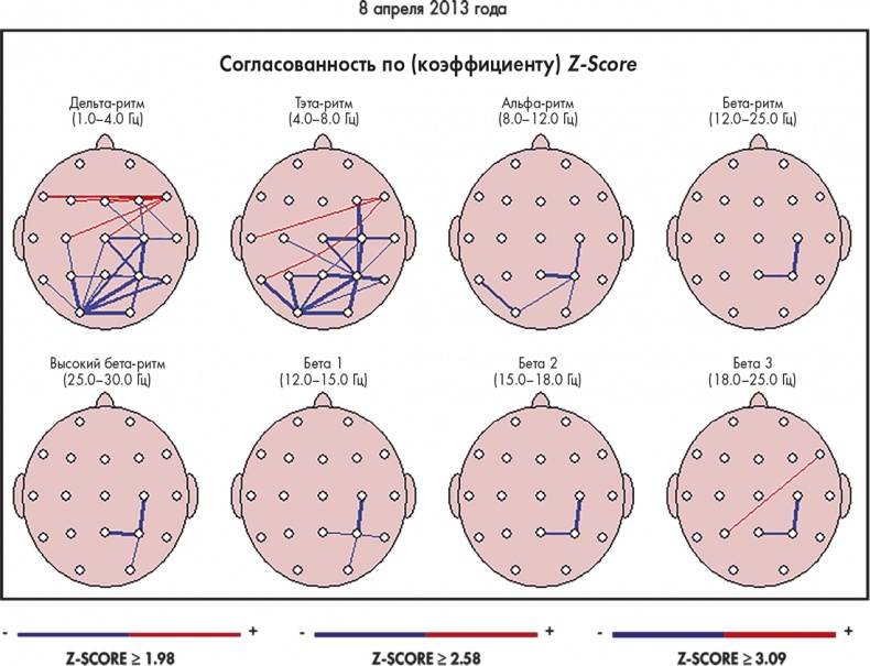 Иллюстрация к книге — Сам себе плацебо: как использовать силу подсознания для здоровья и процветания [i_052.jpg]