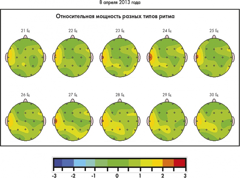 Иллюстрация к книге — Сам себе плацебо: как использовать силу подсознания для здоровья и процветания [i_054.jpg]