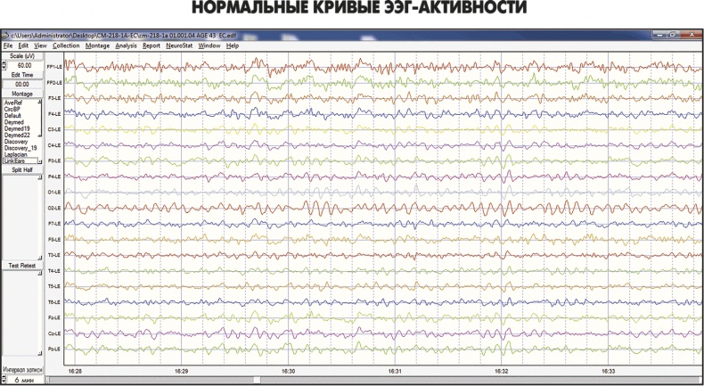 Иллюстрация к книге — Сам себе плацебо: как использовать силу подсознания для здоровья и процветания [i_055.jpg]