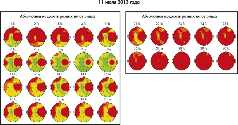 Иллюстрация к книге — Сам себе плацебо: как использовать силу подсознания для здоровья и процветания [i_065.jpg]