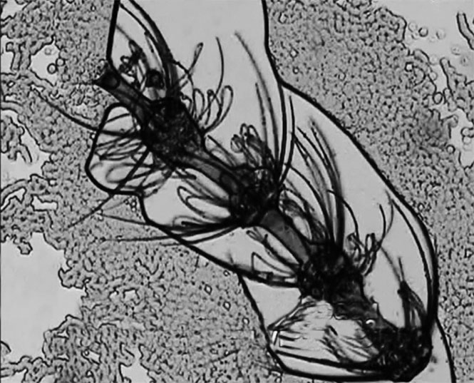 Иллюстрация к книге — Пациент Разумный. Ловушки "врачебной" диагностики, о которых должен знать каждый [i_011.jpg]