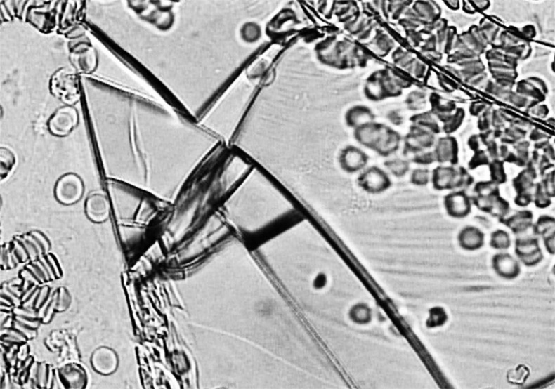 Иллюстрация к книге — Пациент Разумный. Ловушки "врачебной" диагностики, о которых должен знать каждый [i_014.jpg]