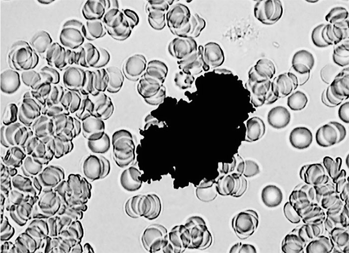 Иллюстрация к книге — Пациент Разумный. Ловушки "врачебной" диагностики, о которых должен знать каждый [i_015.jpg]