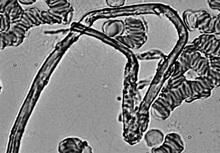 Иллюстрация к книге — Пациент Разумный. Ловушки "врачебной" диагностики, о которых должен знать каждый [i_018.jpg]