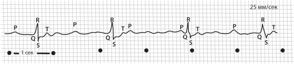 Иллюстрация к книге — Тук-тук, сердце! Как подружиться с самым неутомимым органом и что будет, если этого не сделать [i_020.jpg]