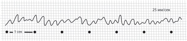 Иллюстрация к книге — Тук-тук, сердце! Как подружиться с самым неутомимым органом и что будет, если этого не сделать [i_021.jpg]