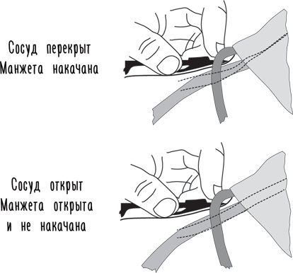 Иллюстрация к книге — Тук-тук, сердце! Как подружиться с самым неутомимым органом и что будет, если этого не сделать [i_026.jpg]