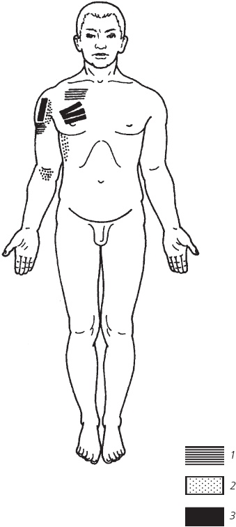 Иллюстрация к книге — Лечебные точки организма. Снимаем боли в суставах и мышцах, укрепляем кожу, вены, сон и иммунитет [_72.jpg]