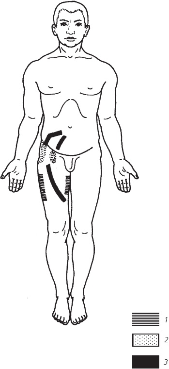Иллюстрация к книге — Лечебные точки организма. Снимаем боли в суставах и мышцах, укрепляем кожу, вены, сон и иммунитет [_76.jpg]