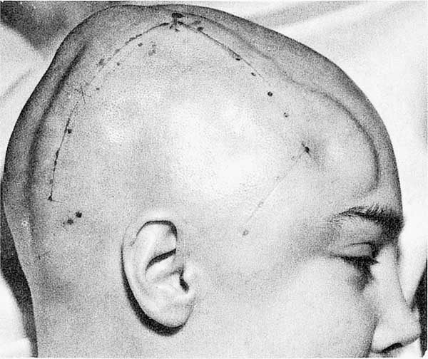 Иллюстрация к книге — Мозг. Тайны разума [i_010.jpg]