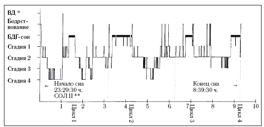 Иллюстрация к книге — 8 недель для победы над бессонницей. Как самостоятельно наладить сон [i_023.jpg]