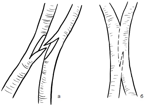 Иллюстрация к книге — Прививка плодовых деревьев: распространенные ошибки и секреты успешной прививки [i_073.jpg]