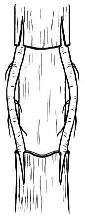 Иллюстрация к книге — Прививка плодовых деревьев: распространенные ошибки и секреты успешной прививки [i_077.jpg]