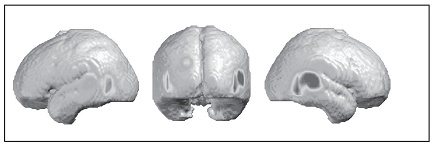 Иллюстрация к книге — Наука о мозге и миф о своем Я. Тоннель Эго [i_011.jpg]