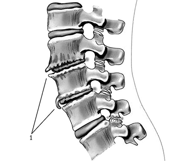 Иллюстрация к книге — Здоровый позвоночник [i_021.jpg]