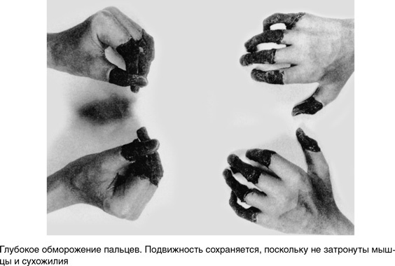 Иллюстрация к книге — На грани возможного. Наука выживания [i_054.jpg]